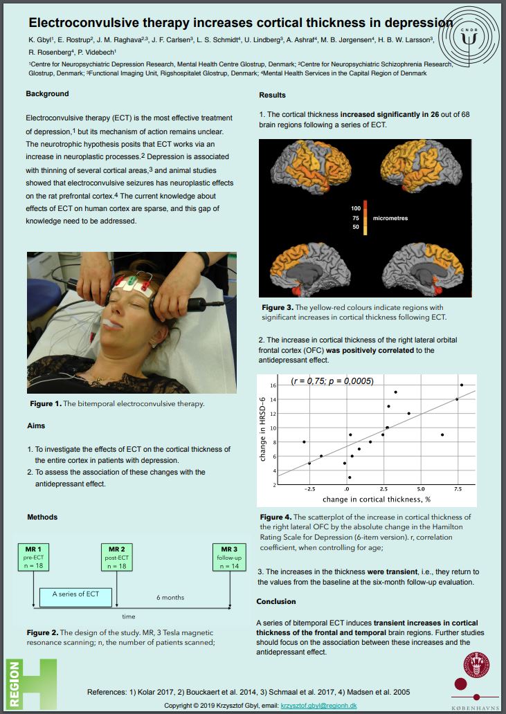 The Danish ECT/MRI project